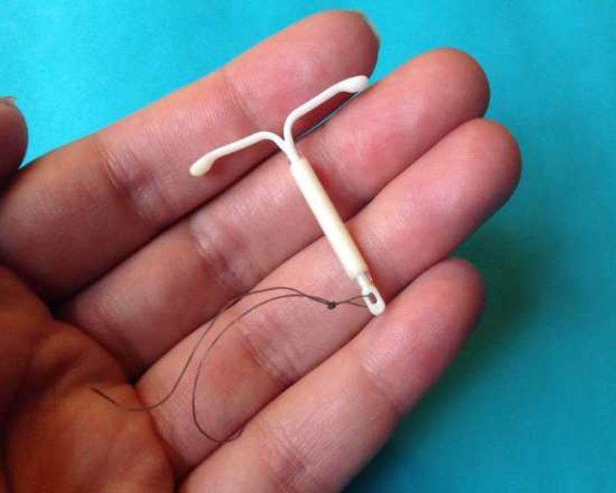 Photo of IUD on someones hand